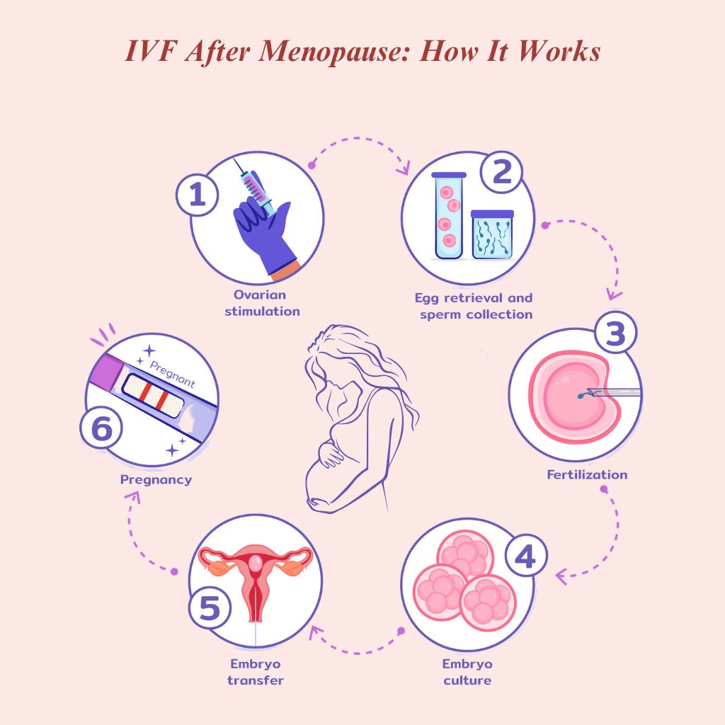 IVF After Menopause How It Works