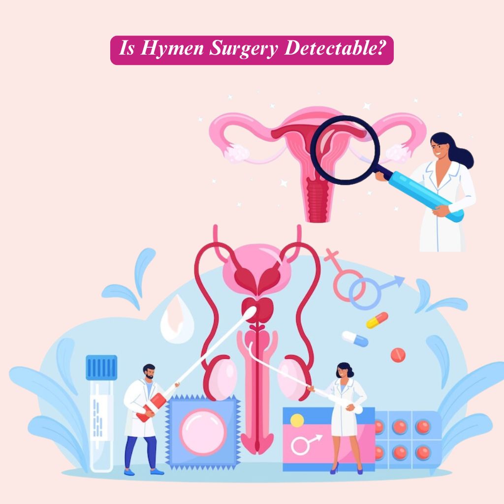 Is Hymen Surgery Detectable