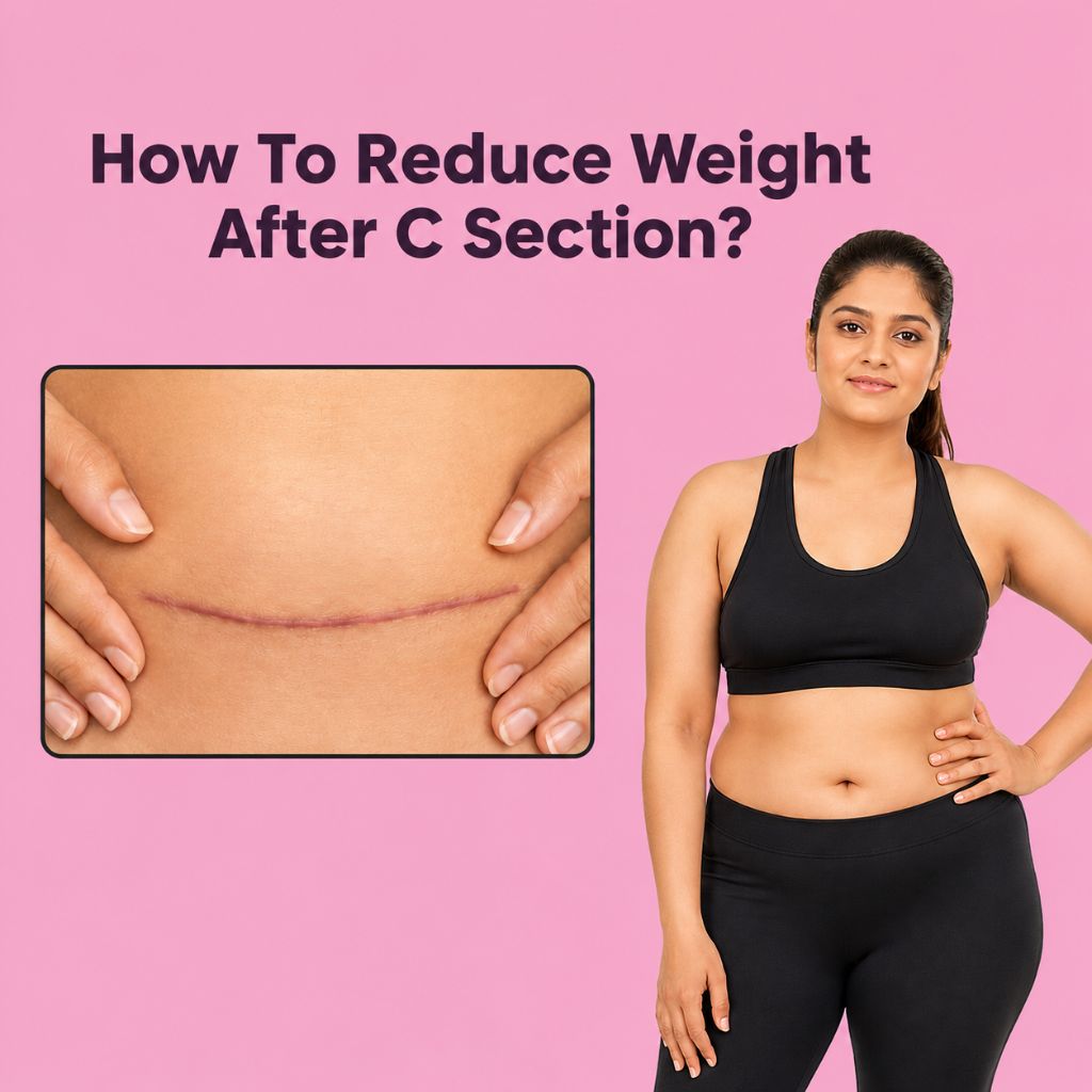 How To Reduce Weight After C Section