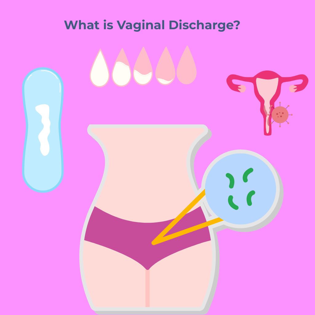 vaginal discharge
