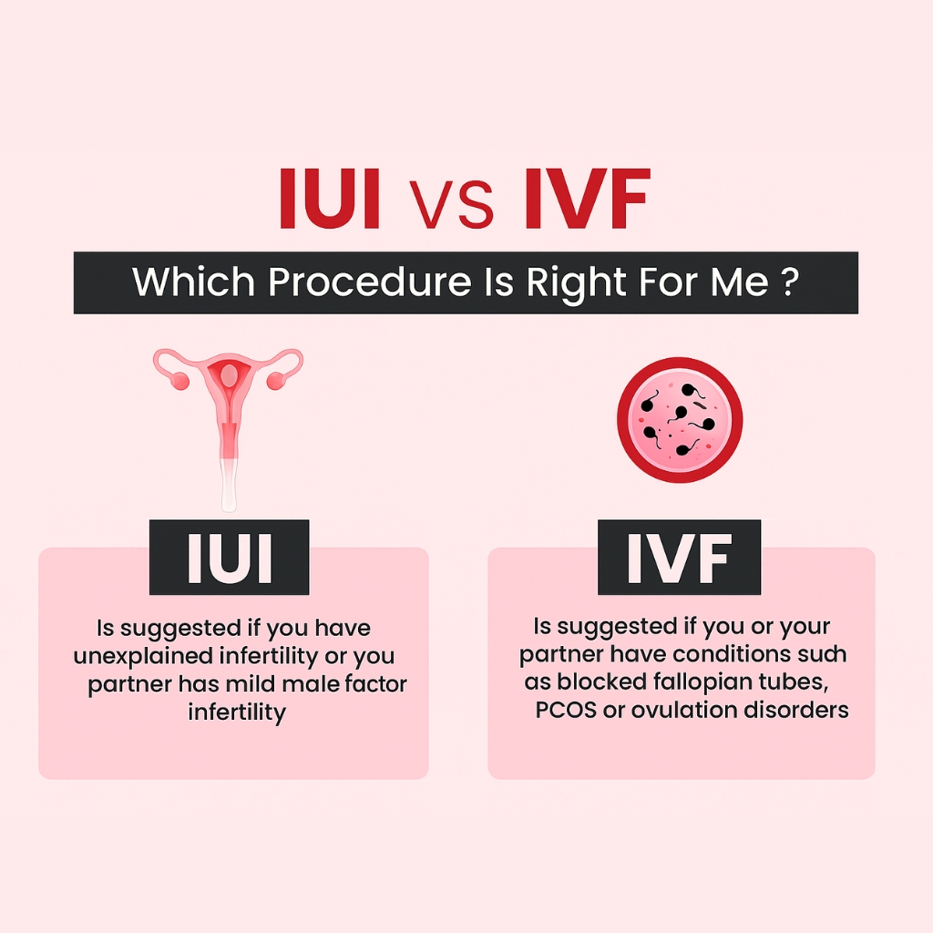 IUI vs IVF in Mumbai