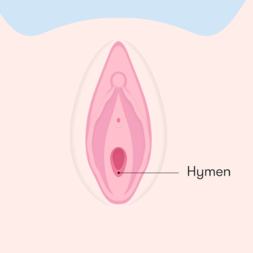Hymen Surgery