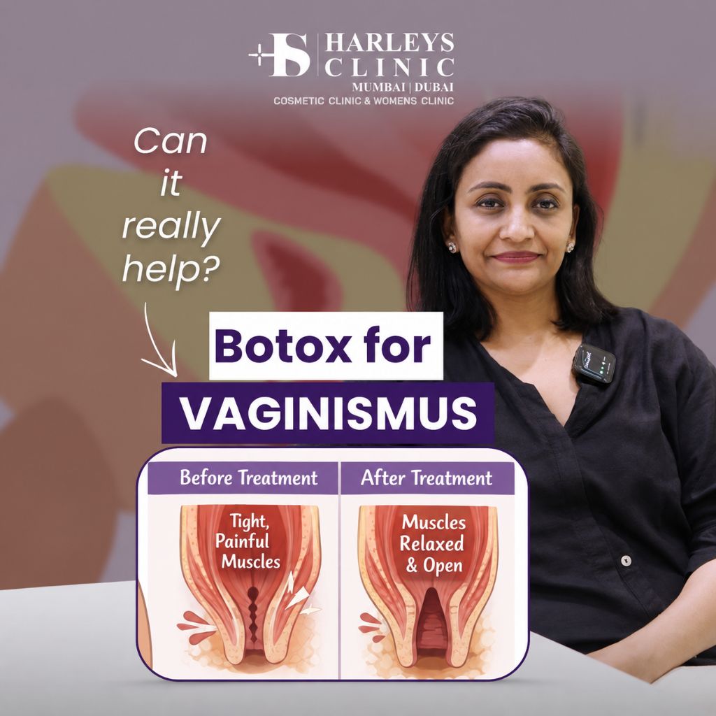 Vaginismus Botox